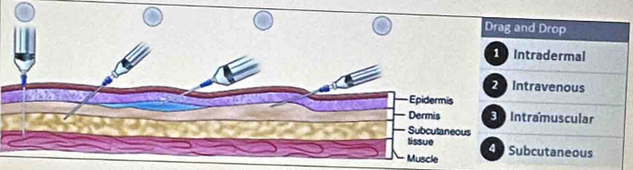 Drop
adermal
avenous
muscular
utaneous