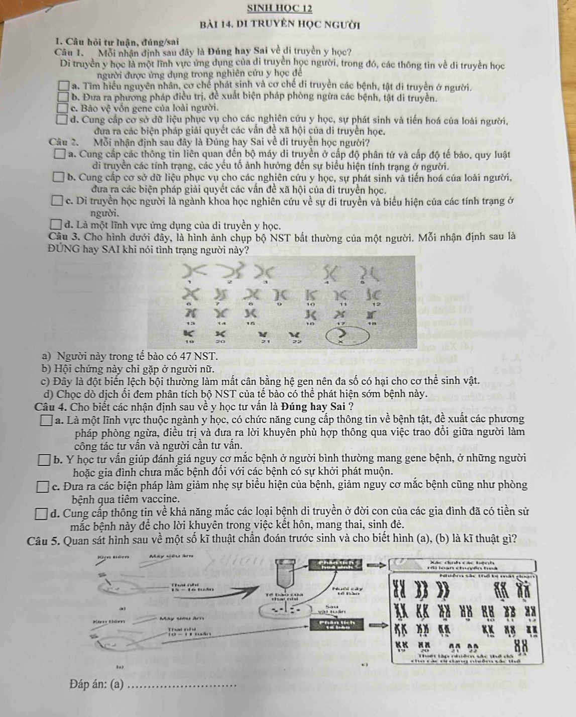 SINH HQC 12
bài 14. DI tRUYÊN Học người
1. Câu hỏi tư luận, đúng/sai
Câu 1. Mỗi nhận định sau đây là Đúng hay Sai về di truyền y học?
Di truyền y học là một lĩnh vực ứng dụng của di truyền học người, trong đó, các thông tin về di truyền học
người được ứng dụng trong nghiên cứu y học để
a. Tìm hiểu nguyên nhân, cơ chể phát sinh và cơ chế di truyền các bệnh, tật di truyền ở người.
b. Đưa ra phương pháp điều trị, đề xuất biện pháp phòng ngừa các bệnh, tật di truyền.
c. Bảo vệ vốn gene của loài người.
d. Cung cấp cơ sở dữ liệu phục vụ cho các nghiên cứu y học, sự phát sinh và tiến hoá của loài người,
đưa ra các biện pháp giải quyết các vấn đề xã hội của di truyền học.
Câu 2. Mỗi nhận định sau đây là Đúng hay Sai về di truyền học người?
a. Cung cấp các thông tin liên quan đến bộ máy di truyền ở cấp độ phân tử và cấp độ tế bảo, quy luật
di truyền các tính trạng, các yếu tố ảnh hưởng đến sự biểu hiện tính trạng ở người.
b. Cung cấp cơ sở dữ liệu phục vụ cho các nghiên cứu y học, sự phát sinh và tiến hoá của loài người,
đưa ra các biện pháp giải quyết các vấn đề xã hội của di truyền học.
c. Di truyền học người là ngành khoa học nghiên cứu về sự di truyền và biểu hiện của các tính trạng ở
người.
d. Là một lĩnh vực ứng dụng của di truyền y học.
Câu 3. Cho hình dưới đây, là hình ảnh chụp bộ NST bất thường của một người. Mỗi nhận định sau là
ĐÚNG hay SAI khi nói tình trạng người này?
a) Người này trong tế bào có 47 NST.
b) Hội chứng này chỉ gặp ở người nữ.
c) Đây là đột biển lệch bội thường làm mất cân bằng hệ gen nên đa số có hại cho cơ thể sinh vật.
d) Chọc dò dịch ối đem phân tích bộ NST của tế bào có thể phát hiện sớm bệnh này.
Câu 4. Cho biết các nhận định sau về y học tư vấn là Đúng hay Sai ?
a. Là một lĩnh vực thuộc ngành y học, có chức năng cung cấp thông tin về bệnh tật, đề xuất các phương
pháp phòng ngừa, điều trị và đưa ra lời khuyên phù hợp thông qua việc trao đồi giữa người làm
công tác tư vấn và người cần tư vấn.
b. Y học tư vấn giúp đánh giá nguy cơ mắc bệnh ở người bình thường mang gene bệnh, ở những người
hoặc gia đình chưa mắc bệnh đối với các bệnh có sự khởi phát muộn.
c. Đưa ra các biện pháp làm giảm nhẹ sự biểu hiện của bệnh, giảm nguy cơ mắc bệnh cũng như phòng
bệnh qua tiêm vaccine.
d. Cung cấp thông tin về khả năng mắc các loại bệnh di truyền ở đời con của các gia đình đã có tiền sử
mắc bệnh này để cho lời khuyên trong việc kết hôn, mang thai, sinh đẻ.
Câu 5. Quan sát hình sau về một số kĩ thuật chần đoán trước sinh và cho biết hình (a), (b) là kĩ thuật gì?
Đáp án: (a)_