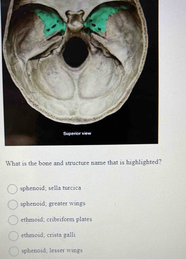 What is the bone and structure name that is highlighted?
sphenoid; sella turcica
sphenoid; greater wings
ethmoid; cribriform plates
ethmoid; crista galli
sphenoid; lesser wings