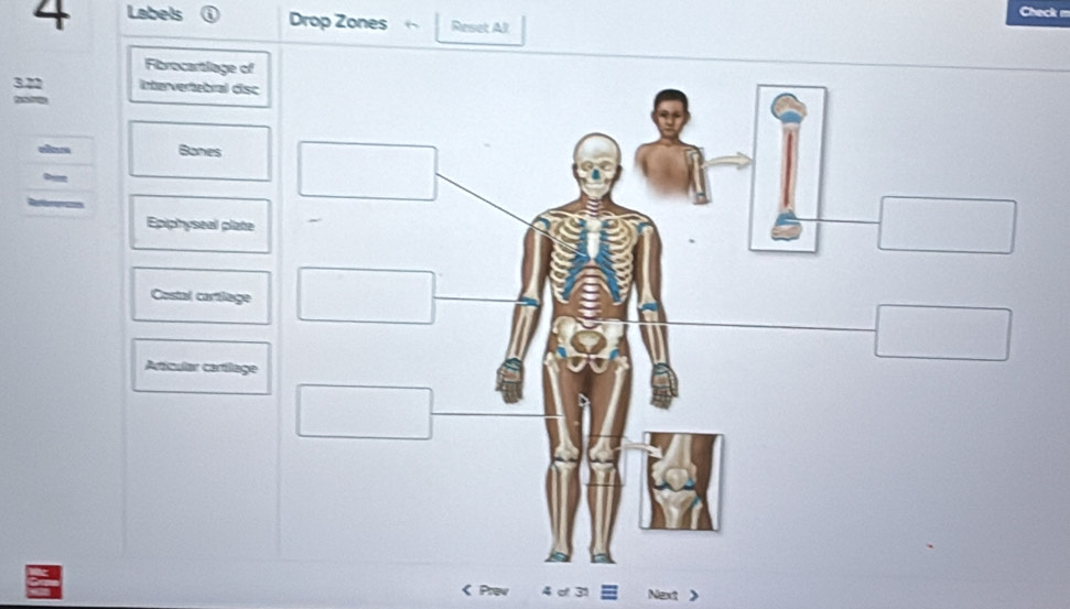 Check m
4 Labels Drop Zones Reset Al
Fibrocartlage of
3.22 Intervertebral disc
,?
Banes
Epiphyseal plate
Costal cartlage
Articular cartlage
4 d 31 Next 》