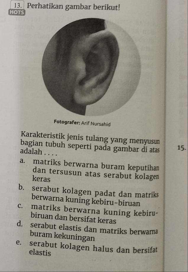 Perhatikan gambar berikut!
HOTS
ahid
Karakteristik jenis tulang yang menyusun
bagian tubuh seperti pada gambar di atas 15.
adalah . . . .
a. matriks berwarna buram keputihan
dan tersusun atas serabut kolagen
keras
b. serabut kolagen padat dan matriks
berwarna kuning kebiru-biruan
c. matriks berwarna kuning kebiru-
biruan dan bersifat keras
d. serabut elastis dan matriks berwarna
buram kekuningan
e. serabut kolagen halus dan bersifat
elastis