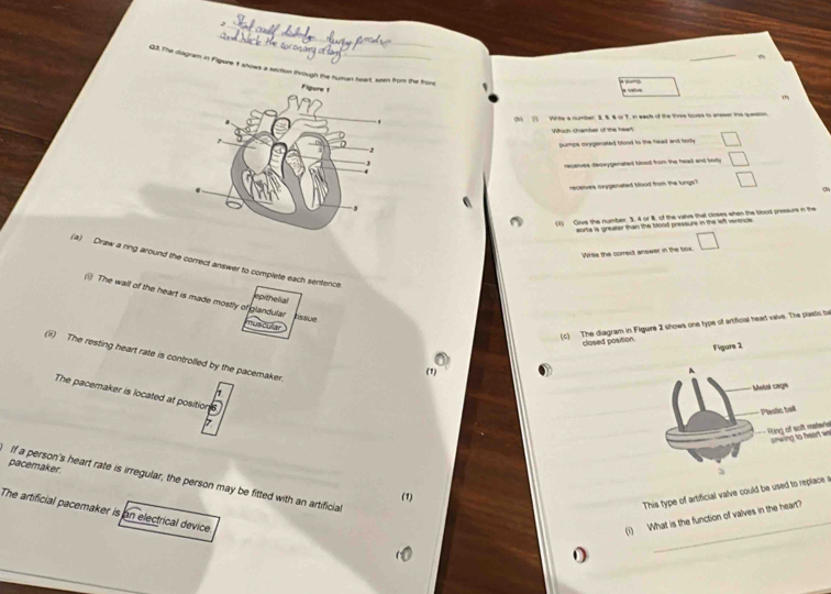 The diagram in Filgure 1 shows a sectiun through the hu the fron 
m 
(5) () Wirite a number 2. 8. 4 or 7. in each of the three borss to aneser this question 
Which chamber of the heart 
pumps corygenated blood to the head and body □ 
recelves demrygenated blood from the head and borh □ 
receives mxygenated blood from the lungs? □ (3 
(i) Give the number. 3. 4 or 8. of the valve that cirses when the bloot pressurs in the 
aorta is greater than the blond pressure in the lef ventricie 
Write the correct answer in the box □ 
(a) Draw a ring around the correct answer to complete each sentence 
() The wall of the heart is made mostly of glandular tissue 
ep theo al 
muscular 
(c) The diagram in Figure 2 shows one type of artificial heart vaive. The plastic be 
closed position. 
(iii) The resting heart rate is controlled by the pacemaker. 
(1 
The pacemaker is located at position 
7 
- Ring of soft matera snwing to heart w 
pacemaker. 
If a person's heart rate is irregular, the person may be fitted with an artificial 
(1) 
This type of artificial valve could be used to replace a 
_ 
The artificial pacemaker is an electrical device 
(i) What is the function of valves in the heart?