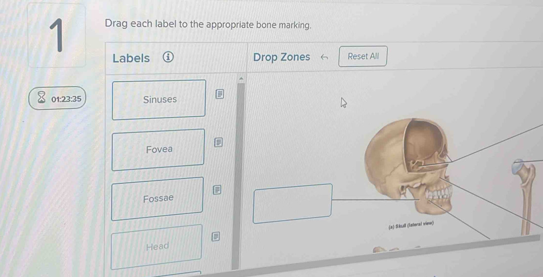 Solved: Drag each label to the appropriate bone marking. Labels Drop ...