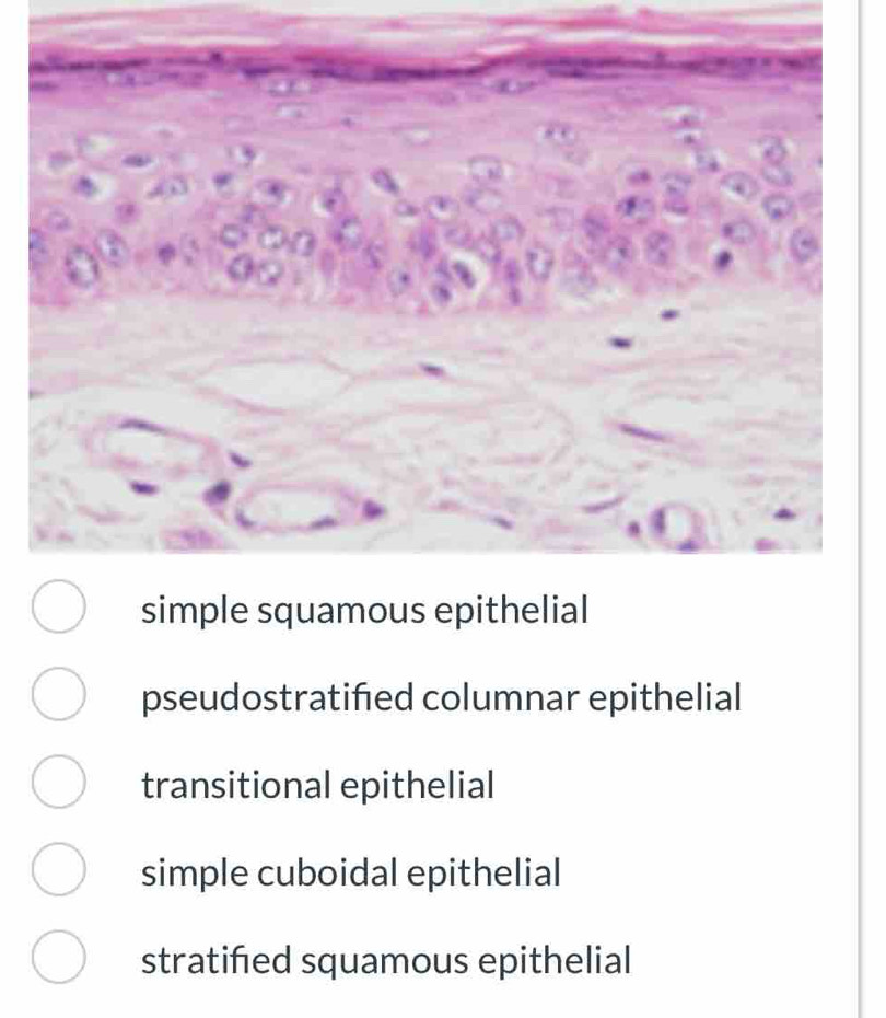 pseudostratifed columnar epithelial
transitional epithelial
simple cuboidal epithelial
stratified squamous epithelial