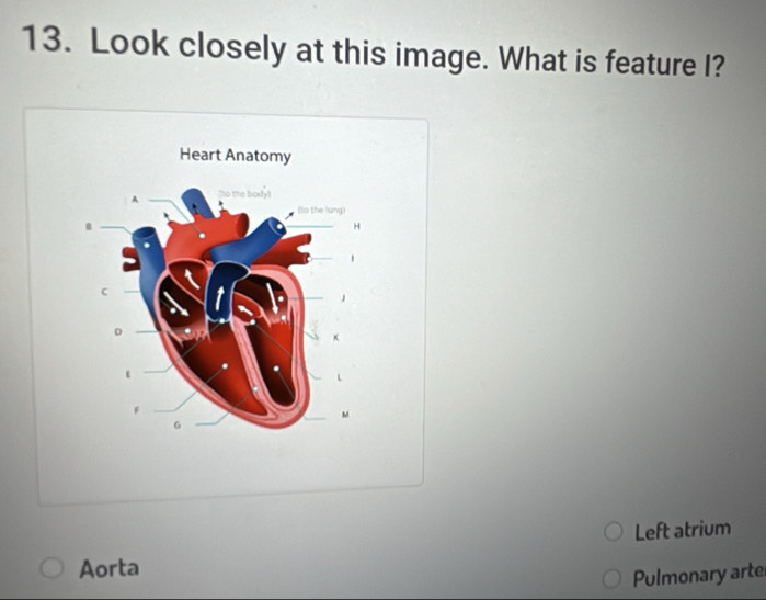 Look closely at this image. What is feature I? 
Heart Anatomy 
A o the bodyt 
(o the lung) 
B 

C 
D 
x 
M 
G 
Left atrium 
Aorta 
Pulmonary arte