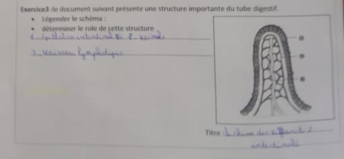 le document suivant présente une structure importante du tube digestif. 
Légender le schéma : 
déterminer le role de cette structure 
_ 
_ 
Titre 
_ 
_