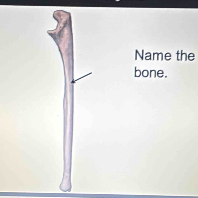 Name the 
bone.