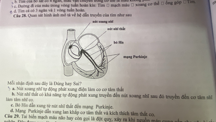 B. Tim của bố sai 88 4 ngàn, mẫu vận chuyền trong có thể là mầu không
c. Đường đi của máu trong vòng tuần hoàn kín: Tim Đ mạch máu → xoang cơ thế Đ ống góp □ Tim. m
d. Tim cá có 3 ngăn và 1 vòng tuần hoàn.
Câu 28. Quan sát hình ảnh mô tả về hệ dẫn truyền của tim như sau
Mỗi nhận định sau đây là Đúng hay Sai?
a. Nút xoang nhĩ tự động phát xung điện làm co cơ tâm thất
b. Nút nhĩ thất có khả năng tự động phát xung truyền đến nút xoang nhĩ sau đó truyền đến cơ tâm nhĩ
làm tâm nhĩ co.
c. Bó His dẫn xung từ nút nhĩ thất đến mạng Purkinje.
d. Mạng Purkinje dẫn xung lan khắp cơ tâm thất và kích thích tâm thất co.
Câu 29. Tai biến mạch máu não hay còn gọi là đột quỵ, xảy ra khi nguồn máu cu ng