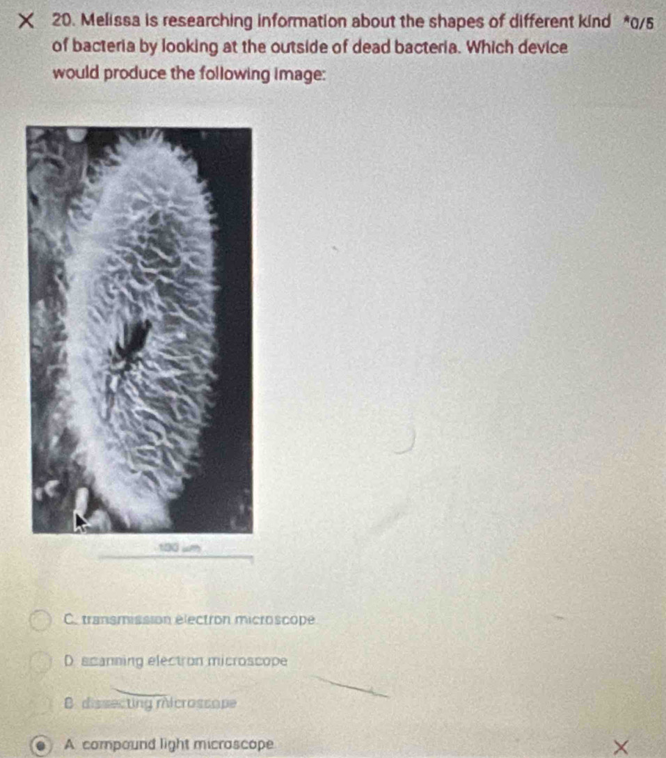 Melissa is researching information about the shapes of different kind * 0/5
of bacteria by looking at the outside of dead bacteria. Which device
would produce the following image:
C. transmission électron microscope
D scanning electron microscope
B. dissecting microssope
A compound light micrascope