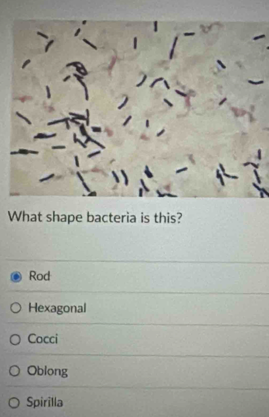 What shape bacteria is this?
Rod
Hexagonal
Cocci
Oblong
Spirilla