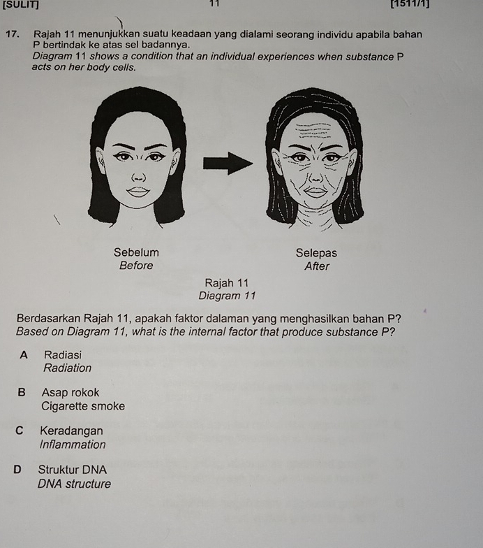 11
[SULIT] [151171]
17. Rajah 11 menunjukkan suatu keadaan yang dialami seorang individu apabila bahan
P bertindak ke atas sel badannya.
Diagram 11 shows a condition that an individual experiences when substance P
acts on her body cells.
Berdasarkan Rajah 11, apakah faktor dalaman yang menghasilkan bahan P?
Based on Diagram 11, what is the internal factor that produce substance P?
A Radiasi
Radiation
B Asap rokok
Cigarette smoke
C Keradangan
Inflammation
D Struktur DNA
DNA structure