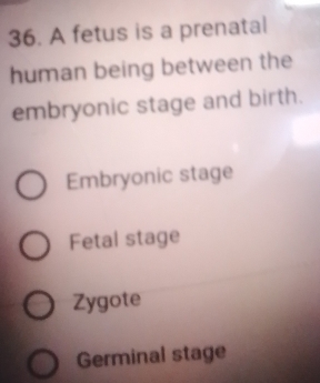 A fetus is a prenatal
human being between the
embryonic stage and birth.
Embryonic stage
Fetal stage
Zygote
Germinal stage