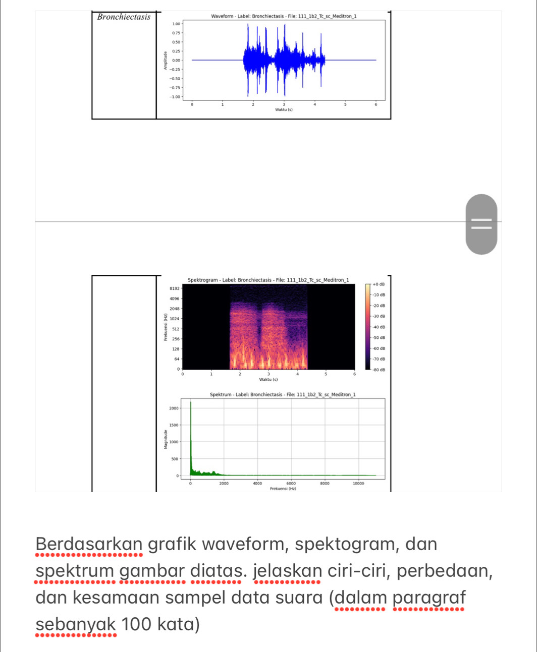 Bronchiecta 
Berdasarkan grafik waveform, spektogram, dan 
spektrum gambar diatas. jelaskan ciri-ciri, perbedaan, 
dan kesamaan sampel data suara (dalam paragraf 
sebanyak 100 kata)