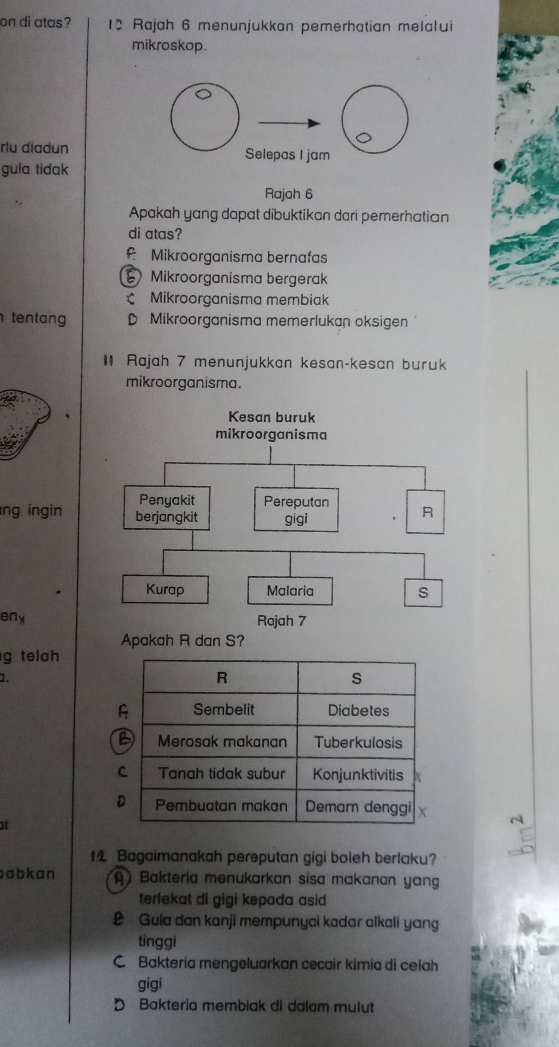 on di atas? 12 Rajah 6 menunjukkan pemerhatian melalui
mikroskop.
rlu diadun
gula tidak
Rajah 6
Apakah yang dapat dibuktikan dari pemerhatian
di atas?
f Mikroorganisma bernafas
Mikroorganisma bergerak
Mikroorganisma membiak
tentang D Mikroorganisma memerlukan oksigen
I Rajah 7 menunjukkan kesan-kesan buruk
mikroorganisma.
ng ingin
eny
Apakah R dan S?
g telah
1.
at
14 Bagaimanakah pereputan gigi boleh berlaku?
abkan Bakteria menukarkan sisa makanan yang
terlekat di gigi kepada asid
L Gula dan kanji mempunyai kadar alkali yang
tinggi
C Bakteria mengeluarkan cecair kimia di ceiah
gigi
D Bakteria membiak di dalam mulut