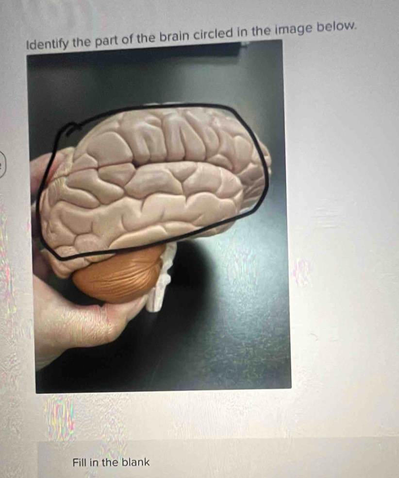 ldentify the part of the brain circled in the image below. 
Fill in the blank