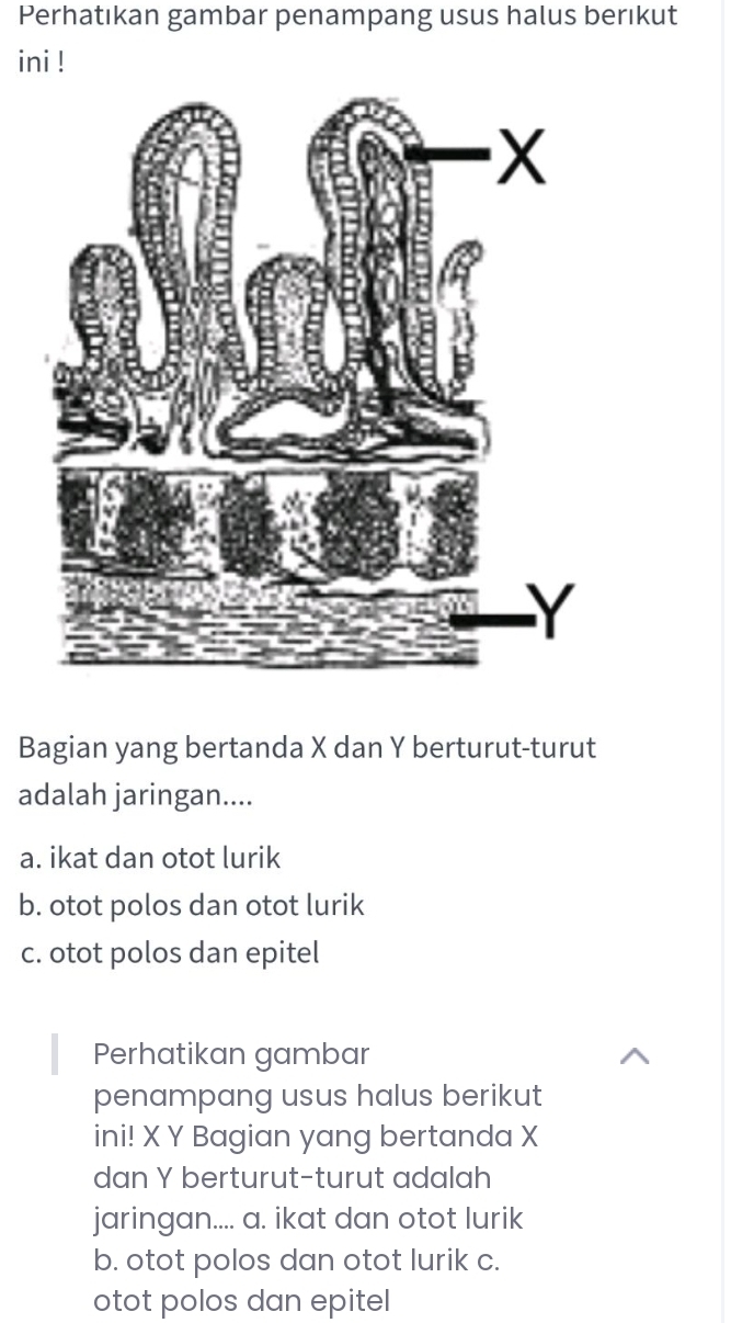 Perhatıkan gambar penampang usus halus berıkut
ini !
Bagian yang bertanda X dan Y berturut-turut
adalah jaringan....
a. ikat dan otot lurik
b. otot polos dan otot lurik
c. otot polos dan epitel
Perhatikan gambar
penampang usus halus berikut
ini! X Y Bagian yang bertanda X
dan Y berturut-turut adalah
jaringan.... a. ikat dan otot lurik
b. otot polos dan otot lurik c.
otot polos dan epitel