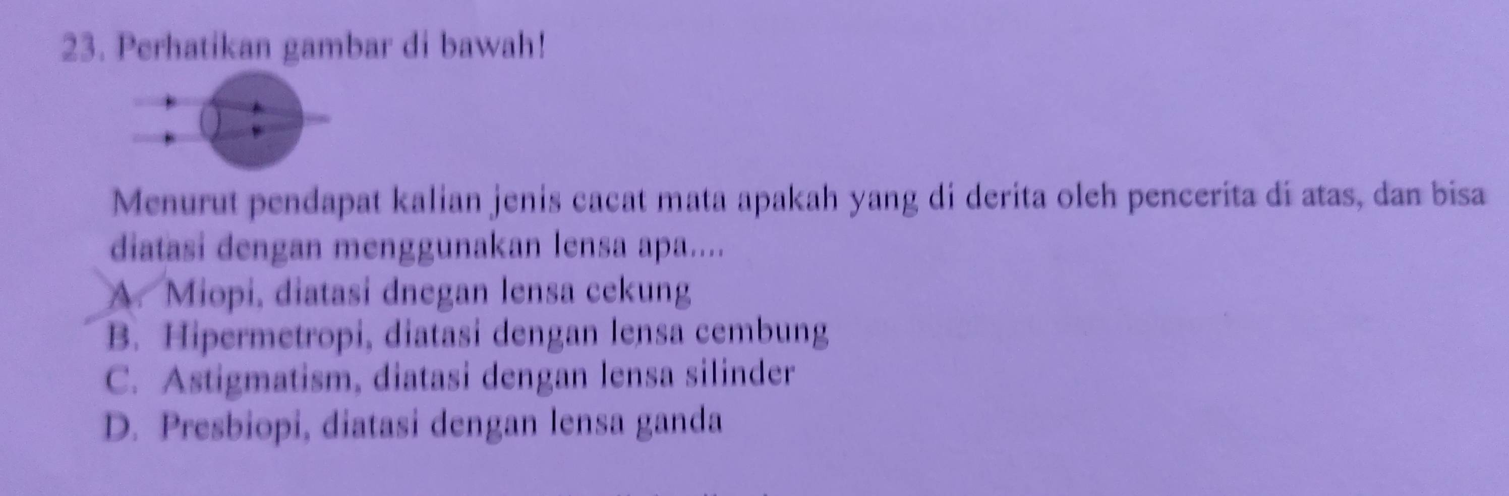 Perhatikan gambar di bawah!
Menurut pendapat kalian jenis cacat mata apakah yang di derita oleh pencerita di atas, dan bisa
diatasi dengan menggunakan lensa apa....
A. Miopi, diatasi dnegan lensa cekung
B. Hipermetropi, diatasi dengan lensa cembung
C. Astigmatism, diatasi dengan lensa silinder
D. Presbiopi, diatasi dengan lensa ganda