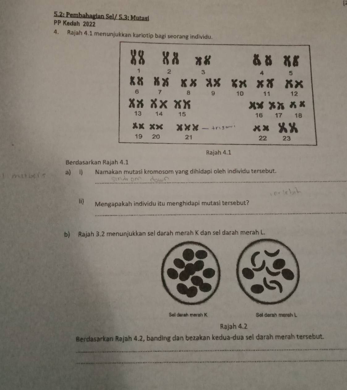 5.2: Pembahagian Sel/ 5.3: Mutasi 
PP Kedah 2022 
4. Rajah 4.1 menunjukkan kariotip bagi seorang individu. 
Rajah 4.1 
Berdasarkan Rajah 4.1 
a) i) Namakan mutasi kromosom yang dihidapi oleh individu tersebut. 
_ 
_ 
1i) Mengapakah individu itu menghidapi mutasi tersebut? 
b) Rajah 3.2 menunjukkan sel darah merah K dan sel darah merah L. 
Sel darah merah K Sol darah mereh L
Rajah 4.2 
Berdasarkan Rajah 4.2, banding dan bezakan kedua-dua sel darah merah tersebut. 
_ 
_