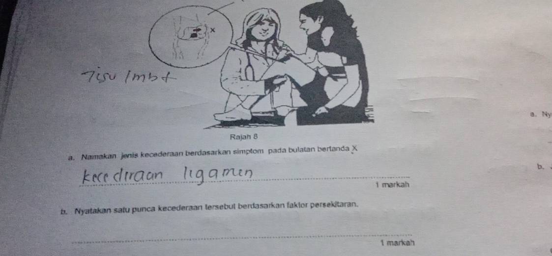 Ny 
a. Namakan jenis kecederaan berdasarkan simptom pada bulatan bertan 
b. 
_ 
i markah 
b. Nyatakan satu punca kecederaan lersebul berdasarkan faklor persekitaran. 
_ 
1 markah