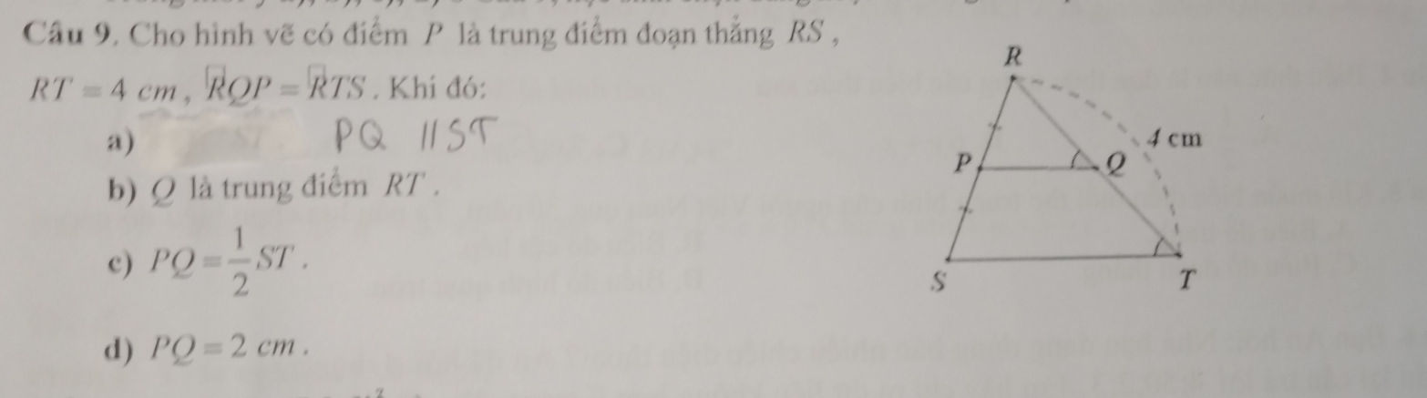 Cho hình vẽ có điểm P là trung điểm đoạn thẳng RS ,
RT=4cm, RQP=RTS. Khi đó:
a)
b) Q là trung điểm RT.
c) PQ= 1/2 ST.
d) PQ=2cm.