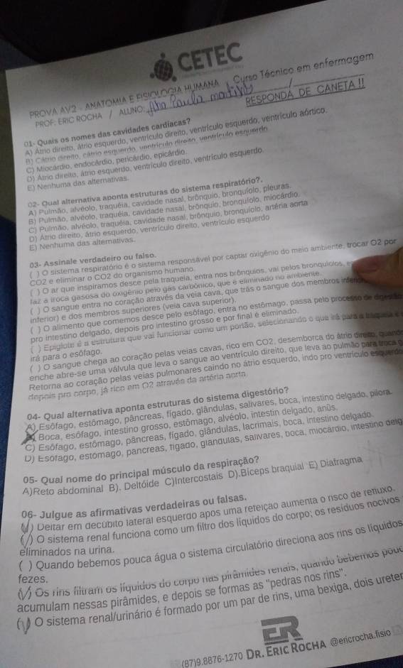 CETEC
PROVA AV2 - ANATOMIA E FISIOLOGIA HUMANA  Curso Técnico em enfermagem
PROF: ERIC ROCHA / ALUNO: CANeTA !!
A) Atrio direito, átrio esquerdo, ventrículo direito, ventrículo esquerdo, ventrículo aórtico,
01- Quais os nomes das cavidades cardíacas?
B) Cátrio direito, cátrio esquerdo, ventrículo direito, ventrículo esquerdo
C) Miocárdio, endocárdio, pericárdio, epicárdio.
3) Atrio direito, átrio esquerdo, ventrículo direito, ventrículo esquerdo,
E) Nenhuma das alternativas.
02- Qual alternativa aponta estruturas do sistema respiratório?.
A) Pulmão, alveolo, traquéia, cavidade nasal, bronquio, bronquíolo, pleuras.
B) Pulmão, alveolo, traquéla, cavidade nasal, brônquio, bronguíolo, miocárdio.
C) Pulmão, alvéolo, traquéia, cavidade nasal, brônquio, bronquíolo, artéria aorta
D) Átrio direito, átrio esquerdo, ventrículo direito, ventrículo esquerdo
E) Nenhuma das alternativas.
) O sistema respiratório é o sistema responsável por captar oxigênio do meio ambiente, trocar O2 por
03- Assinale verdadeiro ou falso.
CO2 e eliminar o CO2 do organismo humano
) O ar que inspiramos desce pela traquela, entra nos brônquios, vai pelos bronquíolos, el
faz a troca gasosa do oxigênio pelo gas carbônico, que é eliminado no ambiente.
) O sangue entra no coração atravês da veia cava, que trãs o sangue dos membros inferio
inferior) e dos membros superiores (veia cava superior).
) O alimento que comemos desce pelo esófago, entra no estômago, passa pelo processo de diresão
pro intestino delgado, depois pro intestino grosso e por final é eliminado.
irá para o esôfago. ( ) Epigiote é a estrutura que vai funcionar como um portão, selecionando o que irá para a bráquda e
) O sangue chega ao coração pelas veias cavas, rico em CO2, desemborca do átrio direto, quaro
enche abre-se uma válvula que leva o sangue ao ventrículo direito, que leva ao pulmão para troca o
Retorna ao coração pelas veias pulmonares caindo no átrio esquerdo, indo pro ventrículo esquerdo
depois pro corpo, já rico em O2 através da artéria aorta
94- Qual alternativa aponta estruturas do sistema digestório?
A) Esôfago, estômago, pâncreas, fígado, giândulas, salivares, boca, intestino delgado, pilora
Boca, esófago, intestino grosso, estômago, alvéolo, intestin delgado, anús,
C) Esófago, estômago, pâncreas, fígado, glândulas, lacrimais, boca, intestino delgado.
D) Esofago, estomago, pancreas, figado, glandulas, salivares, boca, miocardio, intestino delg
05- Qual nome do principal músculo da respiração?
A)Reto abdominal B). Deltóide C)Intercostais D).Biceps braquial E) Diatragma
06- Julgue as afirmativas verdadeiras ou falsas.
) Deitar em decubito lateral esquerdo apos uma refeição aumenta o risco de refluxo.
( /) O sistema renal funciona como um filtro dos liquidos do corpo; os resíduos nocivos
) Quando bebemos pouca água o sistema circulatório direciona aos rins os líquidos
eliminados na urina.
(/) Os rins filtram os líquidos do corpo nas pirâmides renais, quando beberos pour fezes.
acumulam nessas pirâmides, e depois se formas as ''pedras nos rins''.
( ) O sistema renal/urinário é formado por um par de rins, uma bexiga, dois ureter
(87)9.8876-1270 Dr. Eric Rocha @ercrocha.fisio