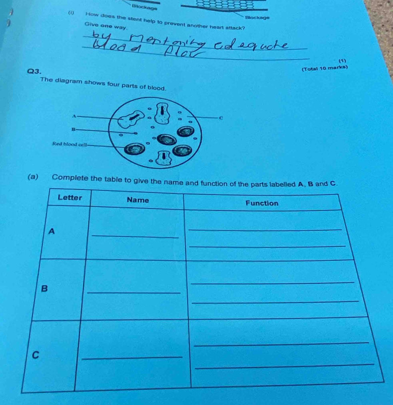 Blockage 
Blockage 
(1) How does the stent help to prevent another heart attack? 
Give one way. 
_ 
_ 
(1) 
Q3. 
(Total 10 marks) 
The diagram shows four parts of blood. 
(a) Complete the table t
