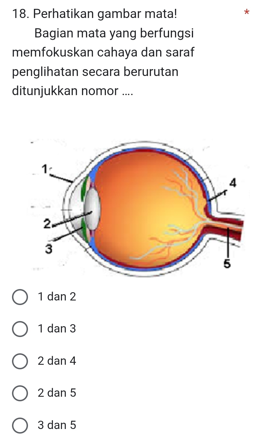 Perhatikan gambar mata!
Bagian mata yang berfungsi
memfokuskan cahaya dan saraf
penglihatan secara berurutan
ditunjukkan nomor ....
1 dan 2
1 dan 3
2 dan 4
2 dan 5
3 dan 5