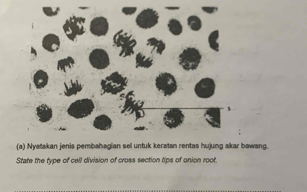 Nyatakan jenis pembahagian sel untuk keratan rentas hujung akar bawang. 
State the type of cell division of cross section tips of onion root. 
_