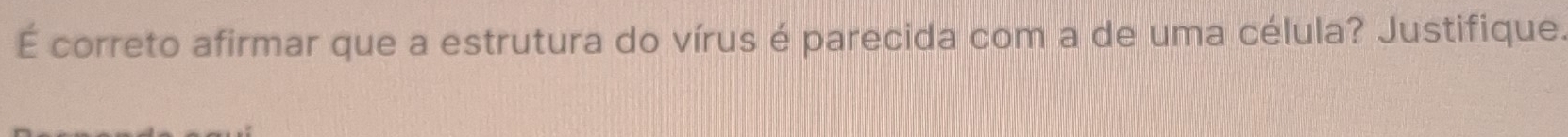 É correto afirmar que a estrutura do vírus é parecida com a de uma célula? Justifique.