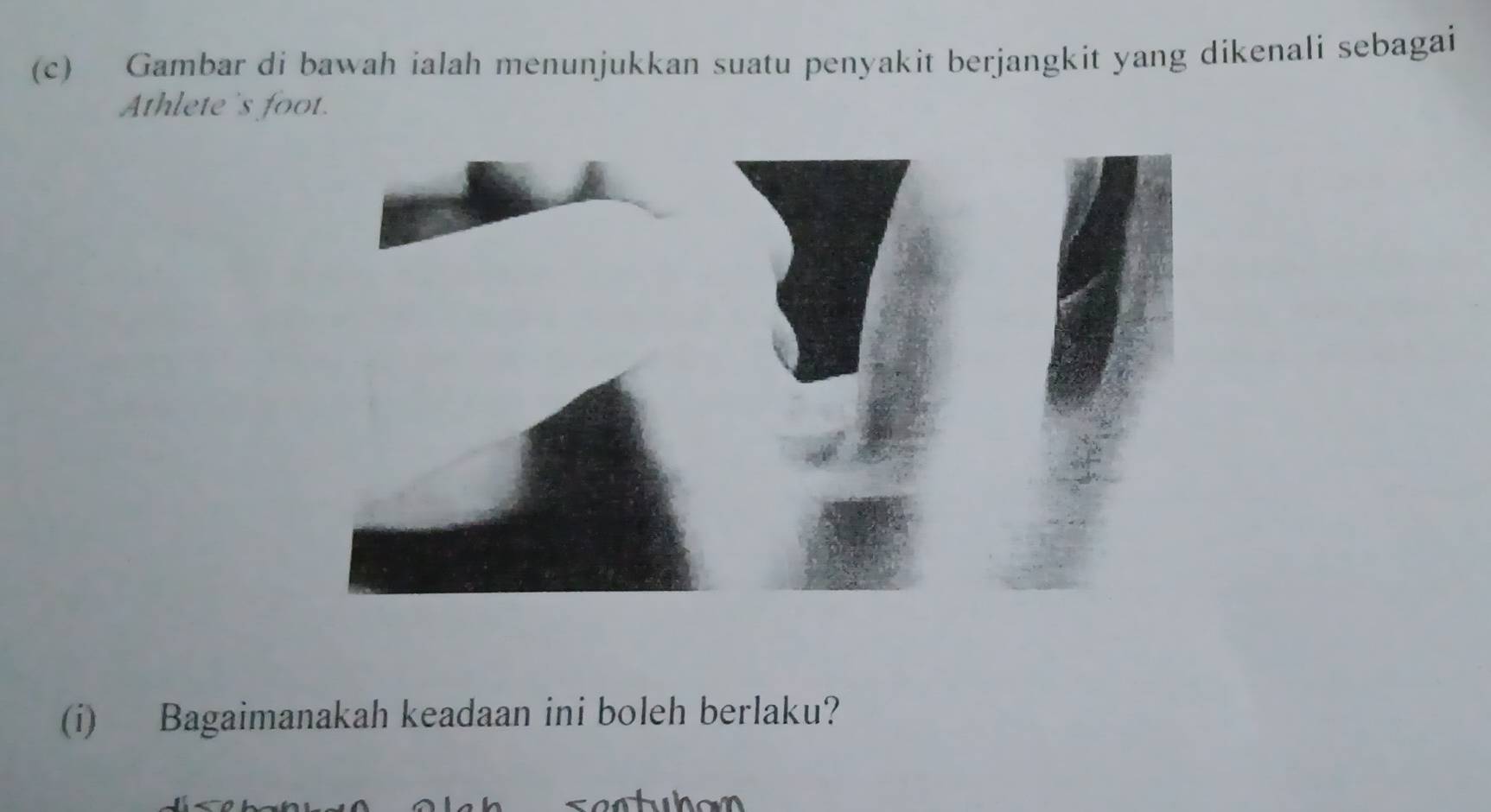 Gambar di bawah ialah menunjukkan suatu penyakit berjangkit yang dikenali sebagai 
Athlete's foot. 
(i) Bagaimanakah keadaan ini boleh berlaku?