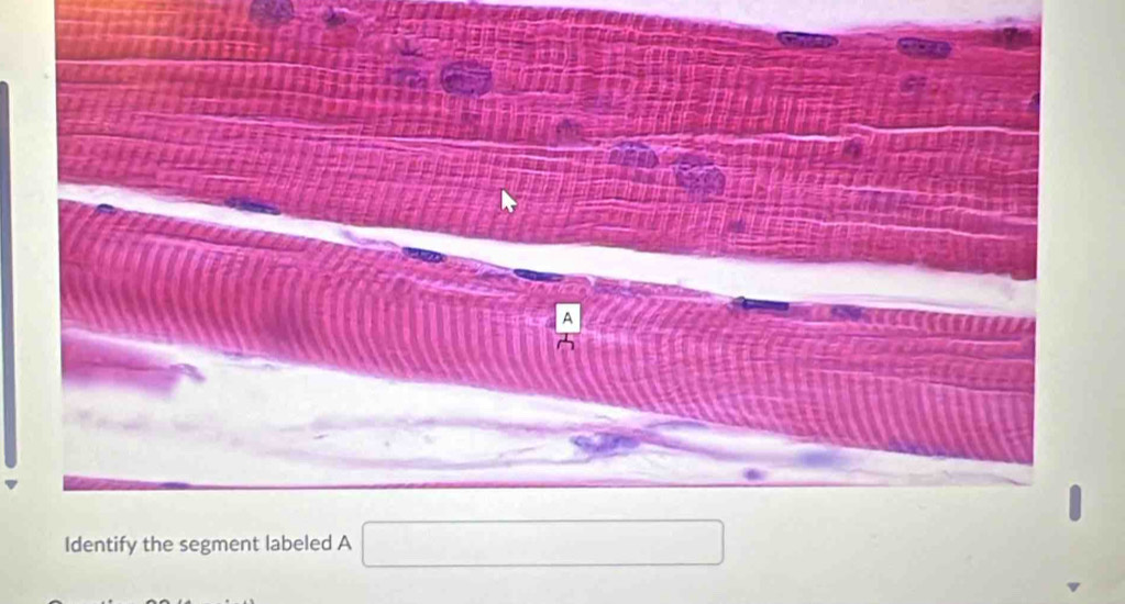 □  
Identify the segment labeled A (-y-()=()^2-() □