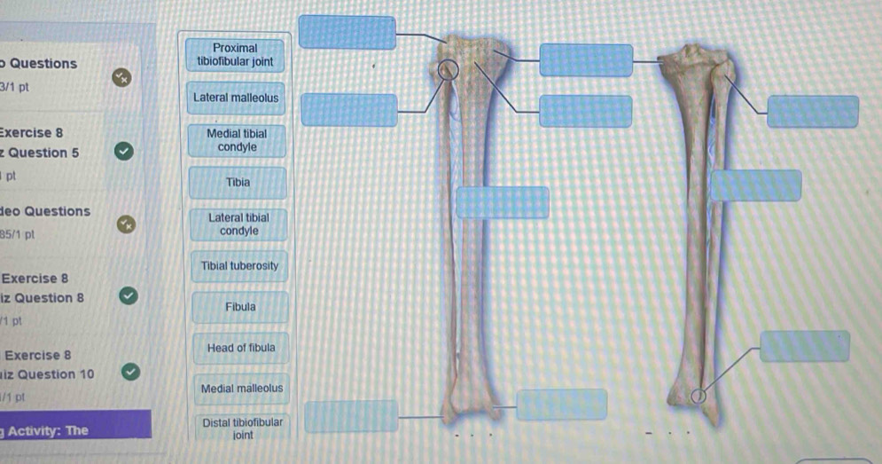 Proximal
Questions tibiofibular joint
3/1 pt
Lateral malleolu
Exercise 8 Medial tibial
Question 5 condyle
pt
Tibia
deo Questions Lateral tibial
85/1 pl condyle
Tibial tuberosit
Exercise 8
iz Question 8 Fibula
/1 pt
Exercise 8 Head of fibula
iz Question 10
Medial malleol
l/1 pt
Distal tibiofibul
Activity: The ioint