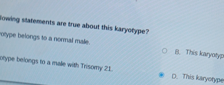 lowing statements are true about this karyotype?
otype belongs to a normal male. B. This karyotyp
otype belongs to a male with Trisomy 21. D. This karyotype