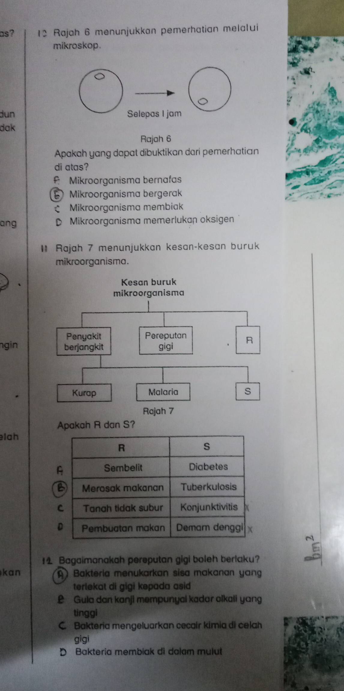 as? 12 Rajah 6 menunjukkon pemerhatian melalui
mikroskop.
dun
dak
Rajah 6
Apakah yang dapat dibuktikan dari pemerhatian
di atas?
Mikroorganisma bernafas
Mikroorganisma bergerak
Mikroorganisma membiak
ang D Mikroorganisma memerlukan oksigen
Rajah 7 menunjukkan kesan-kesan buruk
mikroorganisma.
ngin
Apakah R dan S?
elah
14 Bagaimanakah pereputan gigi boleh berlaku?
kan A Bakteria menukarkan sisa makanan yan
terlekat di gigi kepada asi
£ Gula dan kanji mempunyal kadar olkali yang
tinggi
C. Bakteria mengeluarkan cecair kimia di celah
gigi
D Bakteria membiak di dalam mulut