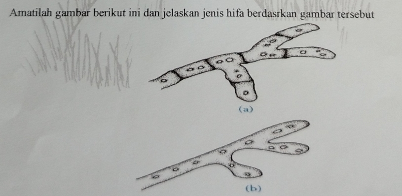 Amatilah gambar berikut ini dan jelaskan jenis hifa berdasrkan gambar tersebut