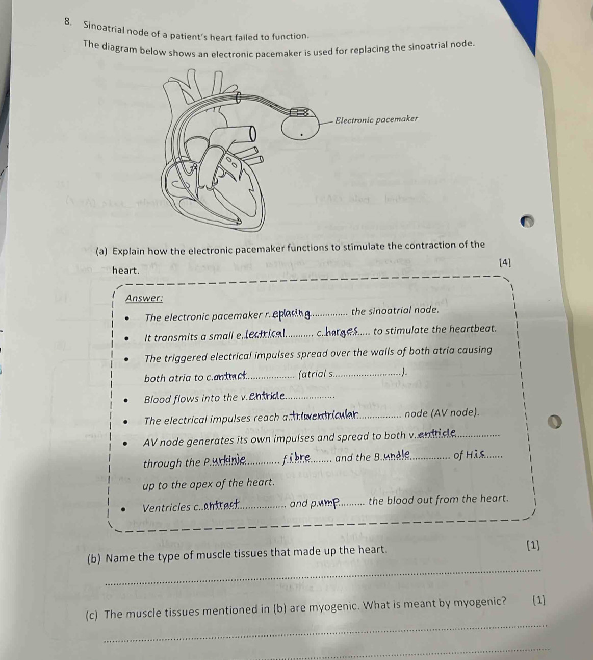 Sinoatrial node of a patient’s heart failed to function. 
The diagram below shows an electronic pacemaker is used for replacing the sinoatrial node. 
(a) Explain how the electronic pacemaker functions to stimulate the contraction of the 
[4] 
heart. 
Answer: 
The electronic pacemaker r eplacing_ the sinoatrial node. 
It transmits a small e.le cal_ charge ..... to stimulate the heartbeat. 
The triggered electrical impulses spread over the walls of both atria causing 
both atria to centack._ (atrial s._ ). 
Blood flows into the v.entrice_ 
The electrical impulses reach a tn wentria _node (AV node). 
AV node generates its own impulses and spread to both v.en tice_ 
f and the Bndle. 
through the ___of Hi. 
up to the apex of the heart. 
Ventricles centrac and p.wmR.._ ... the blood out from the heart. 
(b) Name the type of muscle tissues that made up the heart. 
[1] 
_ 
_ 
(c) The muscle tissues mentioned in (b) are myogenic. What is meant by myogenic? [1] 
_
