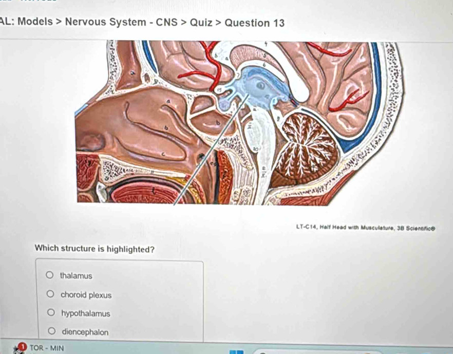 AL: Models > Nervous System - CNS > Quiz > Question 13
LT-C14, Half Head with Musculature, 38 Scientific@
Which structure is highlighted?
thalamus
choroid plexus
hypothalamus
diencephalon
TOR - MIN