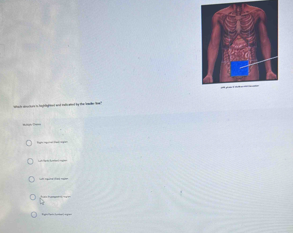 Which structure is highlighted and indicated by the leader line?
Multiple Choice
Right inguinal (ilioc) region
Left flank (lumbar) region
Left inguinal (iliac) region
Pubic (hypogoatric) region
Right flank (lumbar) region