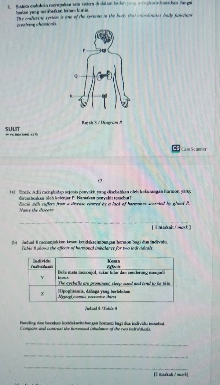 Sistem endokrin merupakan satu sistem di dalam badan yang mengkoordinasikan fungsi 
badan yang melibatkan bahan kimia 
The endicrine system is one of the systems in the body that coordinates body functions 
involving chemicals. 
Rsjsh 8 / Diagram 8 
SULIT 
PP YRE 2024 SAINS K2 TS 
Cs CamScanner 
17 
(a) Encik Adli menghidap sejenis penyakit yang disebabkan oleh kekurangan hormon yang 
dirembeskan oleh kelenjar P. Namakan penyakit tersebut? 
Encik Adli suffers from a disease caused by a lack of hormones secreted by gland R 
Name the disease. 
_ 
[ I markah / mark ] 
(b) Jadual 8 menunjukkan kesan ketidakseimbangan hormon bagi dua individu. 
Table 8 shows the effects of hormonal imbalance for two individuals. 
Jadual 8 /Table 8 
Banding dan bezakan ketidakseimbangan hormon bagi dua individu tersebut 
Compare and contrast the hormonal inbalance of the two individuals. 
_ 
_ 
_ 
(2 marksh / mork]