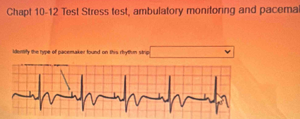 Chapt 10-12 Test Stress test, ambulatory monitoring and pacemal 
Identify the type of pacemaker found on this rhythm strip