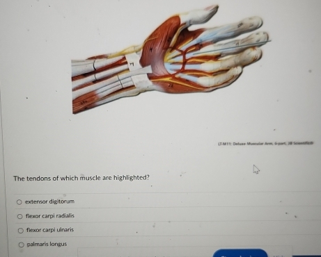 The tendons of which muscle are highlighted?
extensor digitorum
flexor carpi radialis
flexor carpi ulnaris
palmaris longus