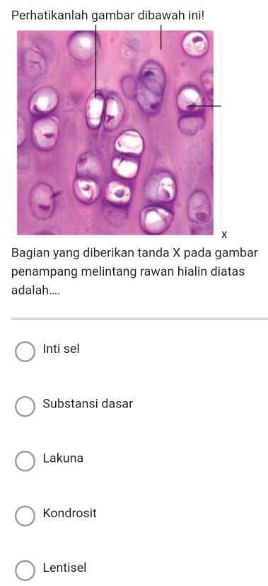 Perhatikanlah gambar dibawah ini!
Bagian yang diberikan tanda X pada gambar
penampang melintang rawan hialin diatas
adalah....
Inti sel
Substansi dasar
Lakuna
Kondrosit
Lentisel