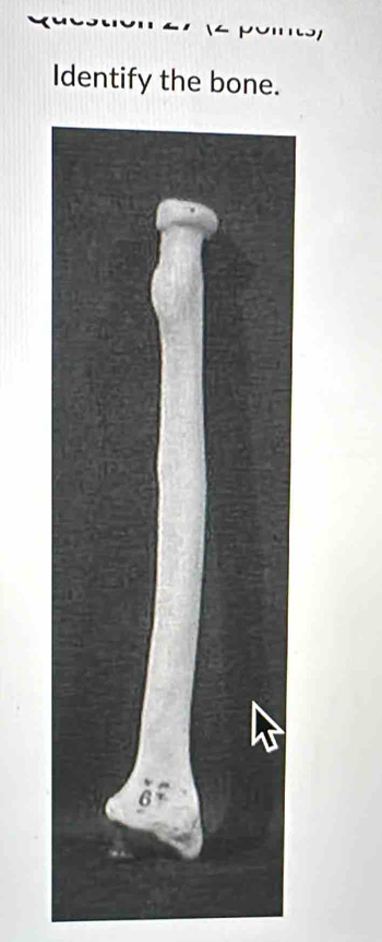 Identify the bone.