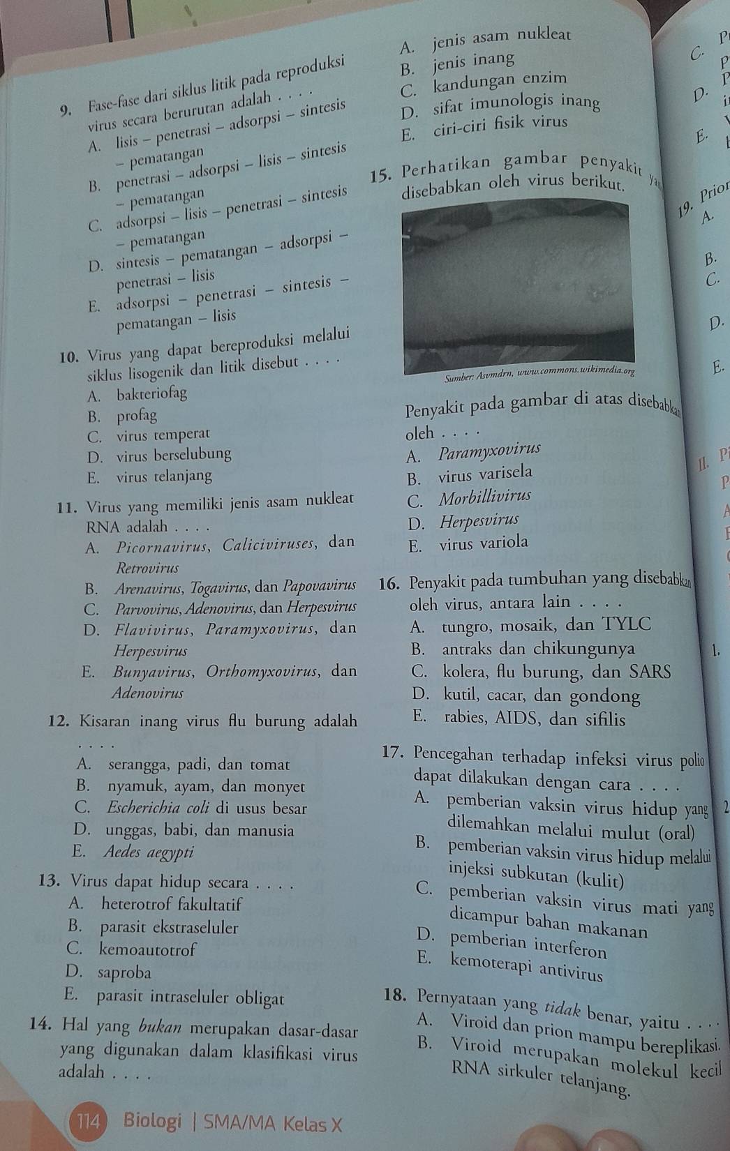 A. jenis asam nukleat
C. F
B. jenis inang
C. kandungan enzim p
9. Fase-fase dari siklus litik pada reproduksi
D. 1
virus secara berurutan adalah . . . .
A. lisis - penetrasi - adsorpsi - sintesis
D. sifat imunologis inang
E. ciri-ciri fsik virus
E.
- pematangan
B. penetrasi - adsorpsi - lisis - sintesis
15. Perhatikan gambar penyakit
9. Prio
- pematangan
C. adsorpsi - lisis - penetrasi - sintesis disebabkan oleh virus berikut. y
A.
- pematangan
D. sintesis - pematangan - adsorpsi -
B.
penetrasi - lisisC.
E. adsorpsi - penetrasi - sintesis -
pematangan - lisis
D.
10. Virus yang dapat bereproduksi melalui
siklus lisogenik dan litik disebut . . . .
A. bakteriofag
E.
B. profag Penyakit pada gambar di atas disebabka
C. virus temperat oleh . . . .
D. virus berselubung A. Paramyxovirus
II. P
E. virus telanjang B. virus varisela
1
11. Virus yang memiliki jenis asam nukleat C. Morbillivirus
RNA adalah . . . .
D. Herpesvirus A
A. Picornavirus, Caliciviruses, dan E. virus variola
Retrovirus
B. Arenavirus, Togavirus, dan Papovavirus 16. Penyakit pada tumbuhan yang disebabka
C. Parvovirus, Adenovirus, dan Herpesvirus oleh virus, antara lain . . . .
D. Flavivirus, Paramyxovirus,dan A. tungro, mosaik, dan TYLC
Herpesvirus B. antraks dan chikungunya 1.
E. Bunyavirus, Orthomyxovirus, dan C. kolera, flu burung, dan SARS
Adenovirus D. kutil, cacar, dan gondong
12. Kisaran inang virus flu burung adalah E. rabies, AIDS, dan sifilis
17. Pencegahan terhadap infeksi virus polio
A. serangga, padi, dan tomat dapat dilakukan dengan cara . . . .
B. nyamuk, ayam, dan monyet A. pemberian vaksin virus hidup yang
C. Escherichia coli di usus besar dilemahkan melalui mulut (oral)
D. unggas, babi, dan manusia
E. Aedes aegypti
B. pemberian vaksin virus hidup melalui
injeksi subkutan (kulit)
13. Virus dapat hidup secara . . . .
C. pemberian vaksin virus mati yang
A. heterotrof fakultatif
dicampur bahan makanan
B. parasit ekstraseluler
D. pemberian interferon
C. kemoautotrof
E. kemoterapi antivirus
D. saproba
E. parasit intraseluler obligat
18. Pernyataan yang tidak benar, yaitu . .
14. Hal yang bukan merupakan dasar-dasar
A. Viroid dan prion mampu bereplikasi
yang digunakan dalam klasifikasi virus
B. Viroid merupakan molekul kecil
adalah . . . .
RNA sirkuler telanjang.
114 Biologi | SMA/MA Kelas X