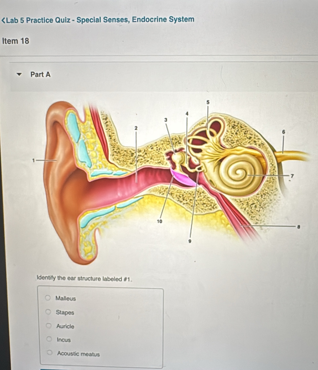 Malleus
Stapes
Auricle
Incus
Acoustic meatus