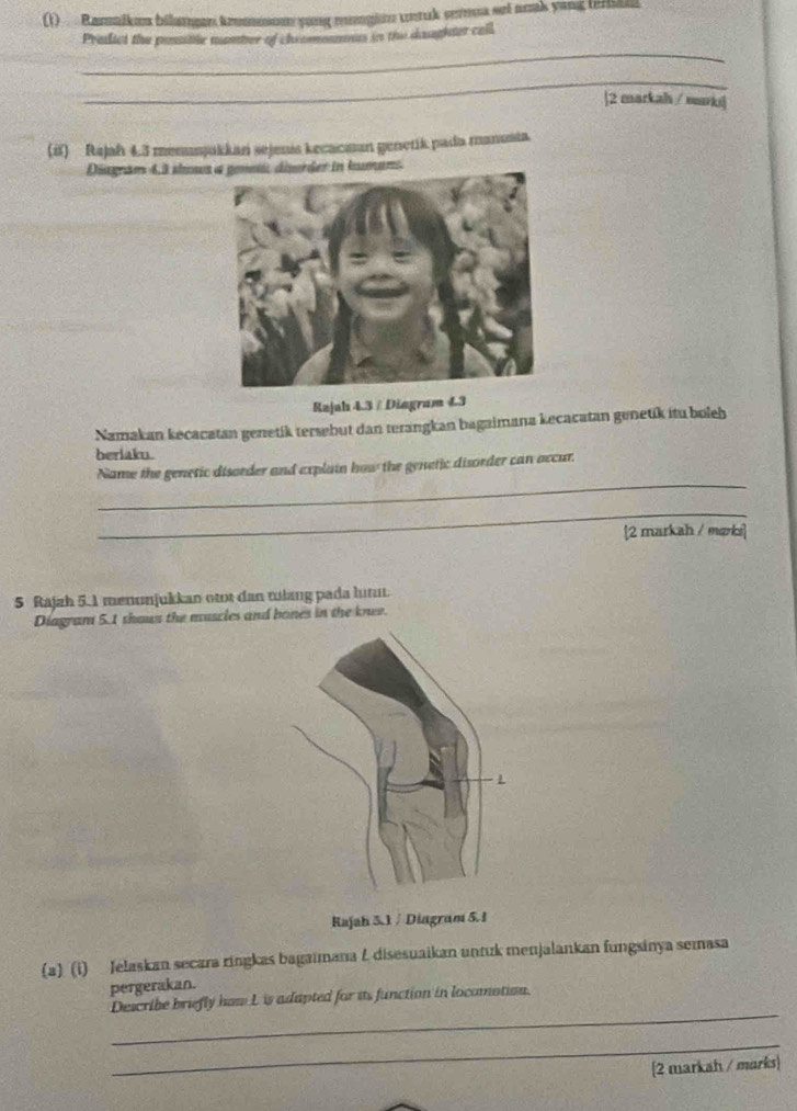 (1) Bamniken bilanen kuon yong mngüür untuk vermna set nek yang (ram 
Prasied the possilc mmber of choamnos in thi daughter call 
_ 
_ 
2 markah / marki| 
(if) Rajah 4.3 memusjukkan sejenis kecacman genetik pada manusta. 
Diagram 4,3 showsans. 
Rajah 4.3 / Diagram 4.3 
Namakan kecacatan genetik tersebut dan terangkan bagaimana kecacatan genetik itu boleh 
berlaku. 
_ 
Name the genetic disorder and explain how the genetic disorder can occur. 
_ 
[2 markah / mørki] 
5 Rajah 5.1 menunjukkan otot dan tulang pada lutut. 
Diagram 5.1 shows the muscles and bones in the knee. 
Rajah 5.1 / Diagram 5. 1 
(a) (i) Jelaskan secara ringkas bagaimana Z disesuaikan untuk menjalankan fungsinya semasa 
pergerakan. 
_ 
Describe briefly how L is adapted for its function in locomation. 
_ 
[2 markah / marks)