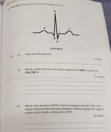 CHAPTER S 
& NGURE 8 represents the electrocardiogram (ECG) 
FIGURE 8 
(2) (1) What does P represent? 
[1 mark] 
_ 
(ii) Briefly explain the cause of greater amplitude in QRS as shown in 
FIGURE 6. 
_ 
[2 marks] 
_ 
_ 
_ 
_ 
(b) Mitral valve prolapse (MVP) refers to improper closure of the valve 
which is present between heart chambers. Briefly explain the stage of 
cardiac cycle which is affected by MVP. 
[4 marks] 
_ 
_