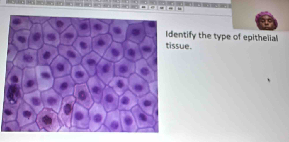 " 9 
or 
ntify the type of epithelial 
ue.