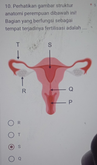 Perhatikan gambar struktur 5
anatomi perempuan dibawah ini!
Bagian yang berfungsi sebagai
tempat terjadinya fertilisasi adalah ....
R
T
S
Q