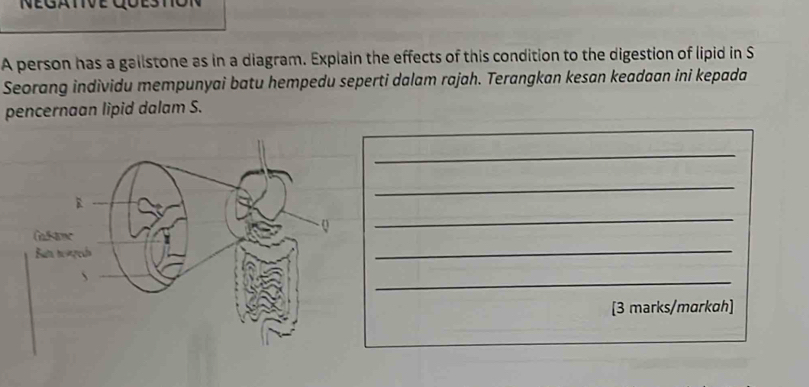 NEGATIVE 
A person has a gailstone as in a diagram. Explain the effects of this condition to the digestion of lipid in S 
Seorang individu mempunyai batu hempedu seperti dalam rajah. Terangkan kesan keadaan ini kepada 
pencernaan lipid dalam S. 
_ 
_ 
_ 
_ 
_ 
[3 marks/mɑrkɑh]